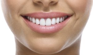 Teeth Whitening with Consultation
