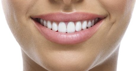 Teeth Whitening with Consultation