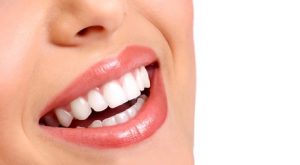 Teeth Whitening