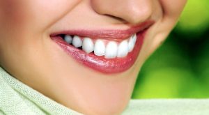 Teeth Whitening with Consultation
