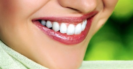 Teeth Whitening with Consultation