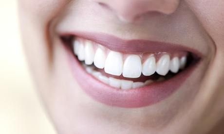 Laser Teeth Whitening