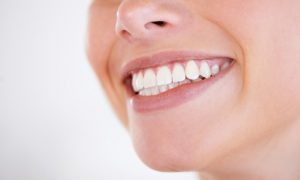 Braces for Lower or Upper Jaw at Montreal