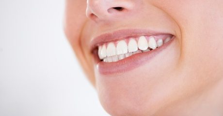 Braces for Lower or Upper Jaw at Montreal