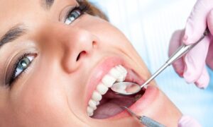 Orthodontic Consultation