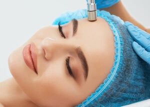 Microdermabrasion with Vitamin C